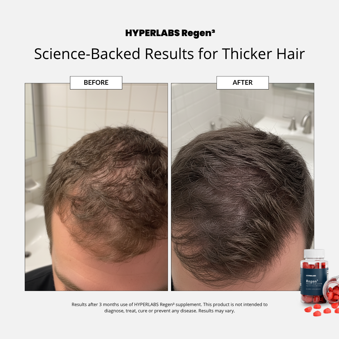 Hyperlabs Regen³ - Hair Growth Gummies