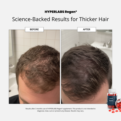 Hyperlabs Regen³ - Hair Growth Gummies